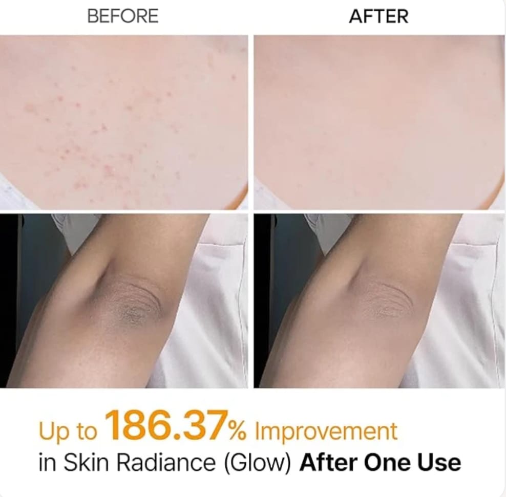 Dr.Melaxin - Peel Shot Kojic Acid Spray