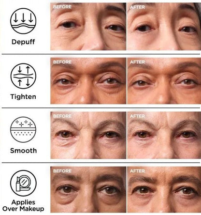 👁️ DR. MELAXIN EYEPHALT CREAM
